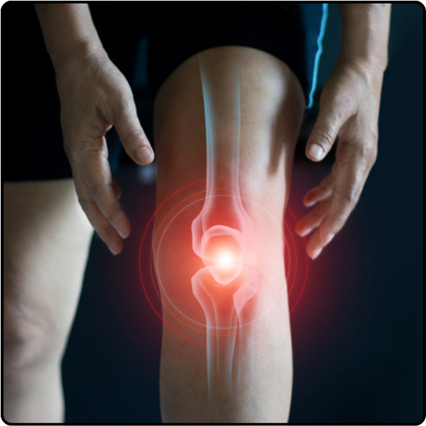 Knee joint pain Picture